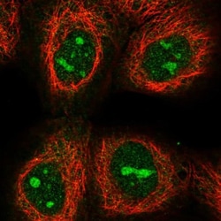 LIAT1 Antibody, Novus Biologicals 0.1mL; Unlabeled:Antibodies, Polyclonal